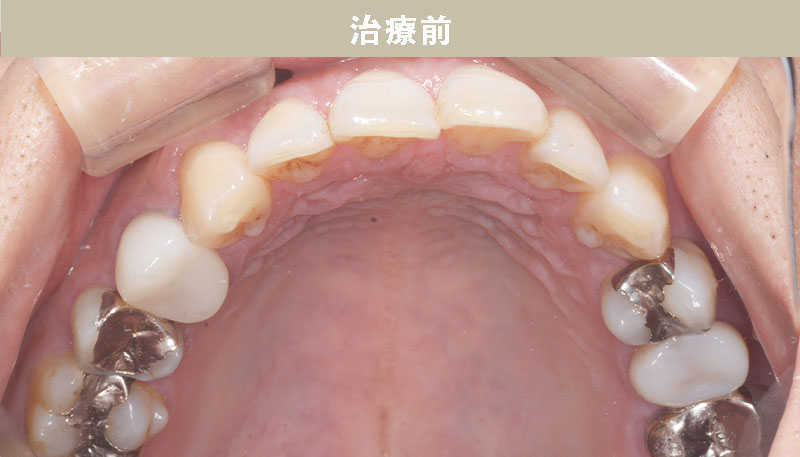 歯並び矯正Case.05