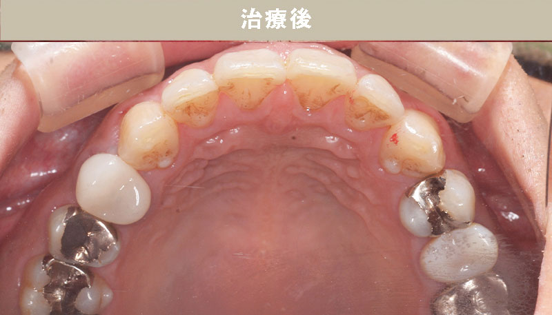歯並び矯正Case.05