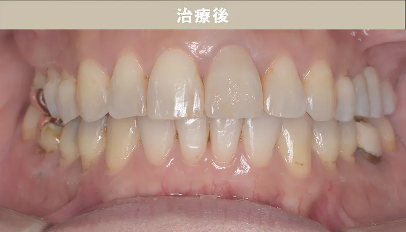 歯並び矯正Case.09