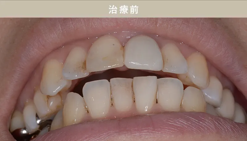歯並び矯正Case.09