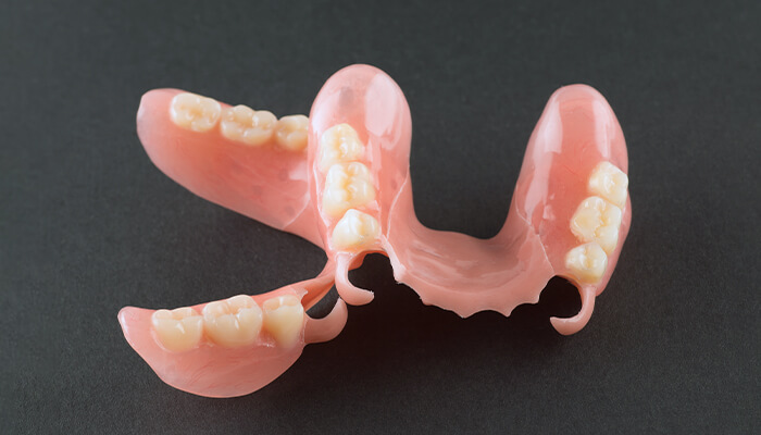 ノンクラスプ・デンチャー