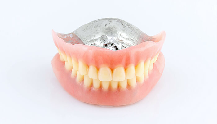 ノンクラスプ・デンチャー