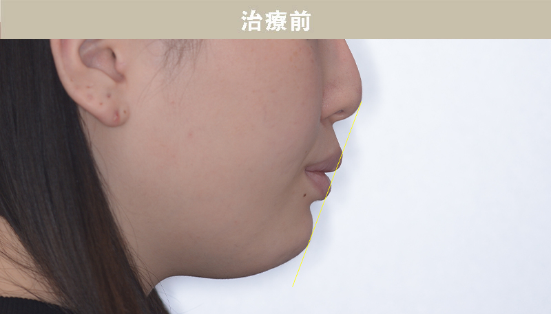 口ゴボの症例Case.03