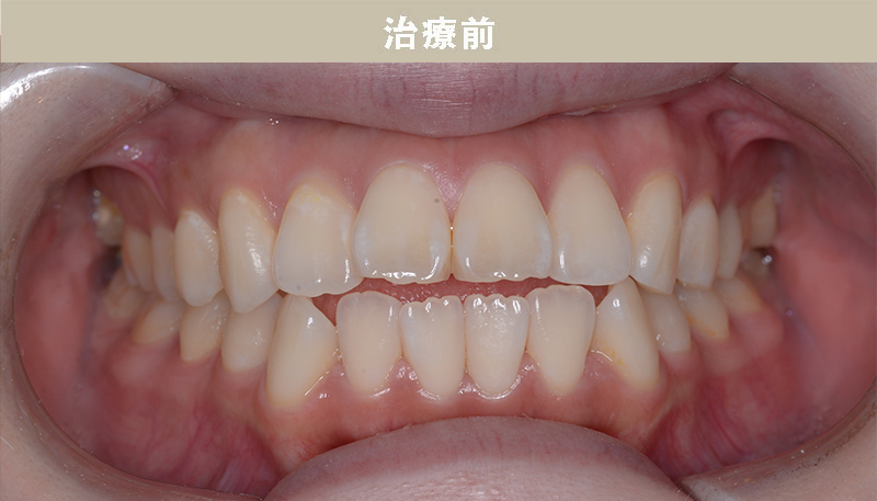 口ゴボの症例Case.03