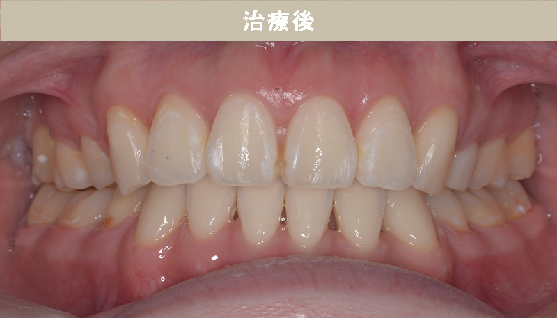 口ゴボの症例Case.03