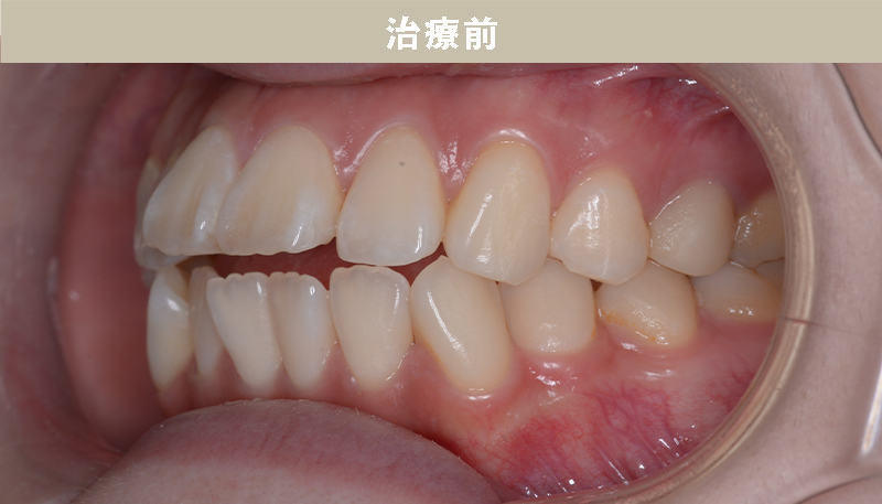 口ゴボの症例Case.03