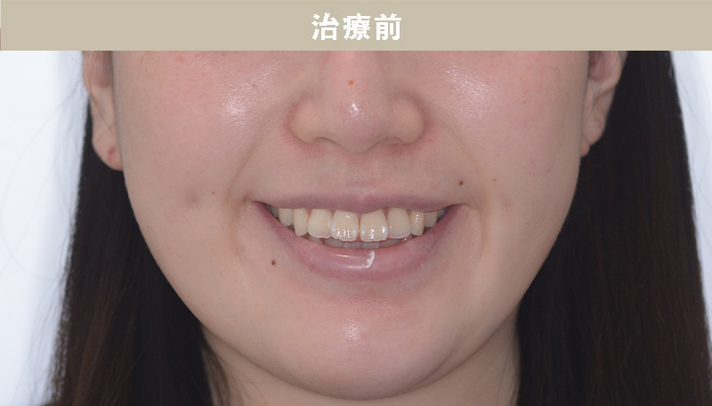 口ゴボの症例Case.03