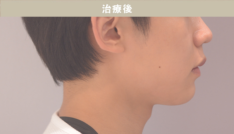 口ゴボの症例Case.04