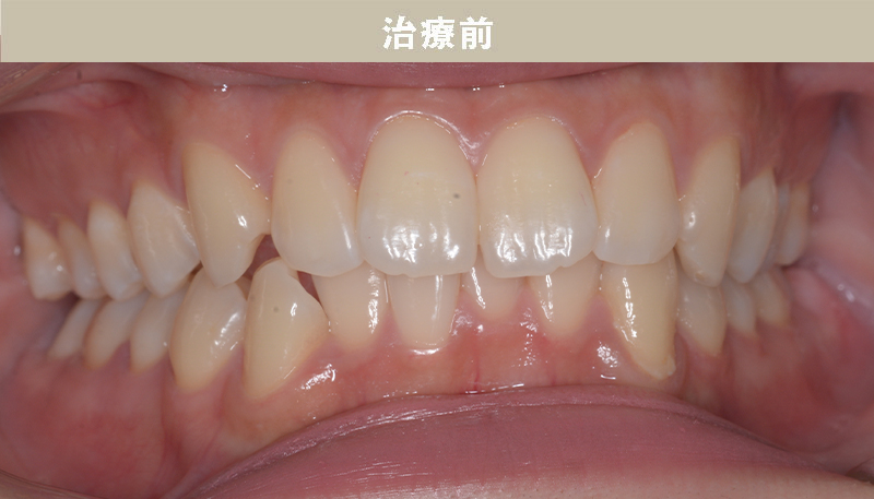 口ゴボの症例Case.04