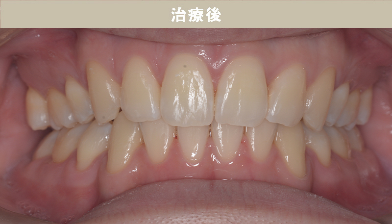 口ゴボの症例Case.04