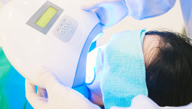 ホワイトニングスタート